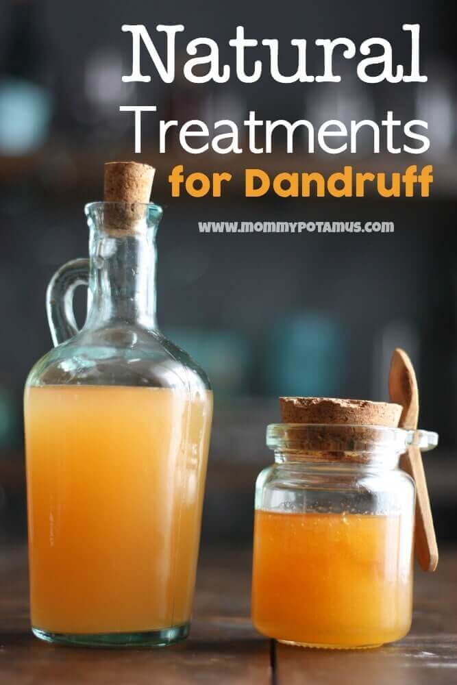 How do you treat dandruff?