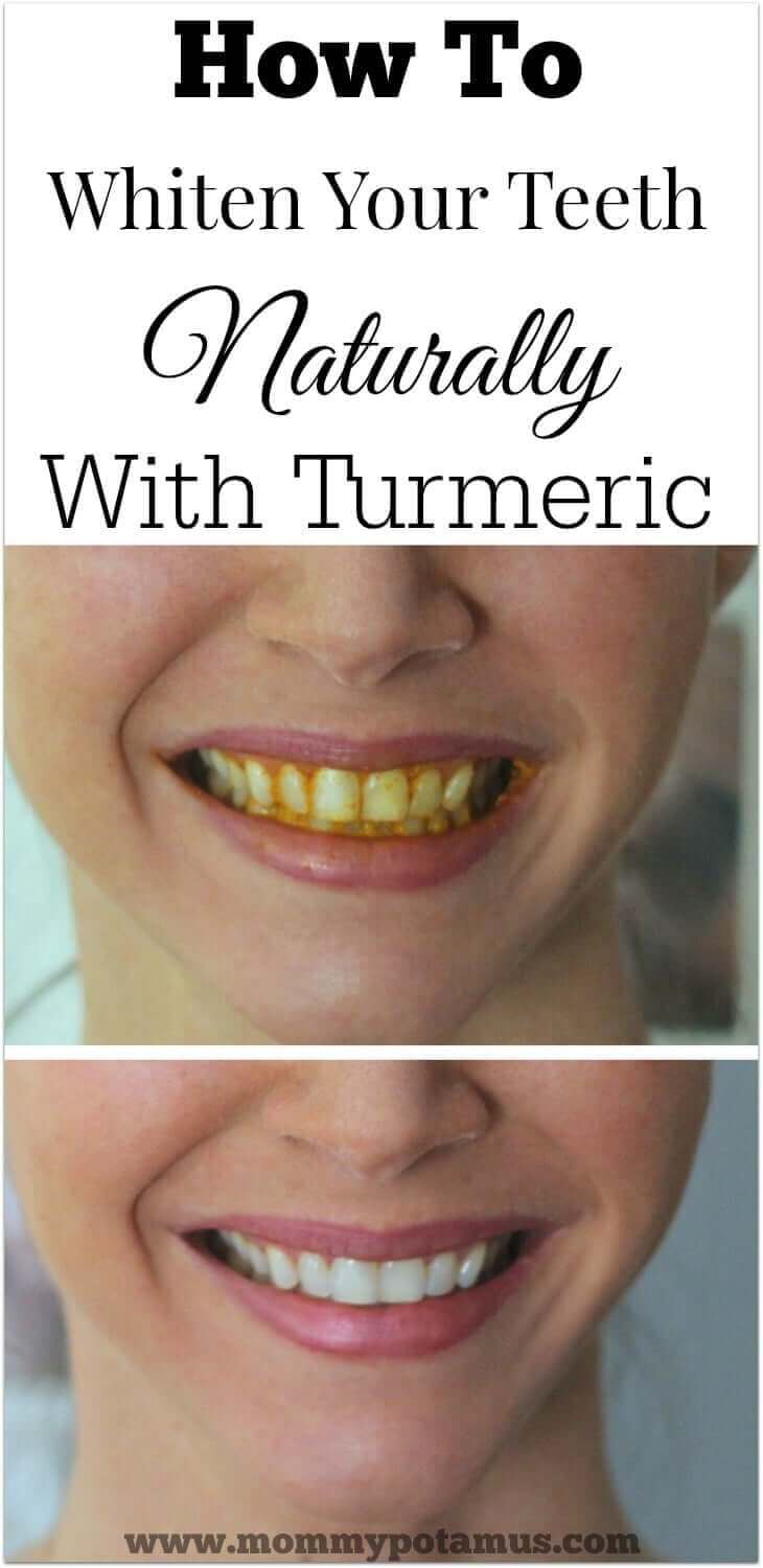 Turmeric Teeth Whitening At Home with Teeth Whitening Diy